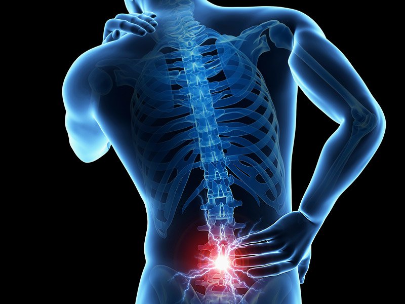 Slipped discs