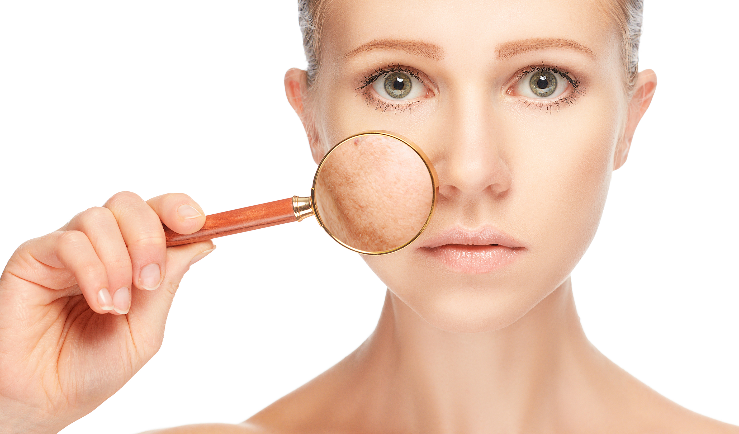 Zygomycosis (Cheek bone inflammation)